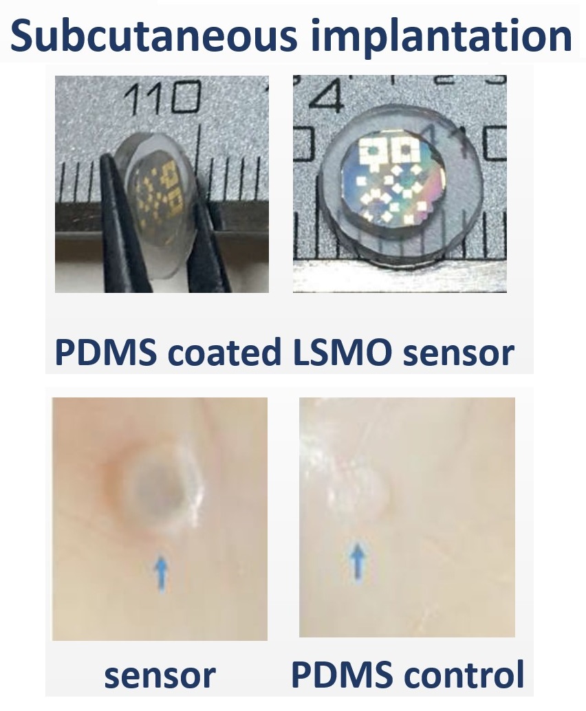 Magnetic sensor encapsulated in PDMS for in-vivo subcutaneous implantation in mice (ACS Biomaterials Science & Engineering 2023, 9 (2), 1020-1029)